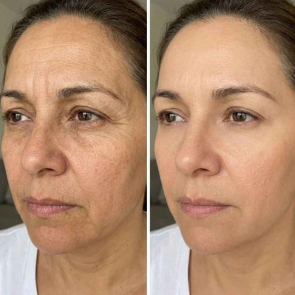 Bottox Filler PDRN y Colágeno - Medicube