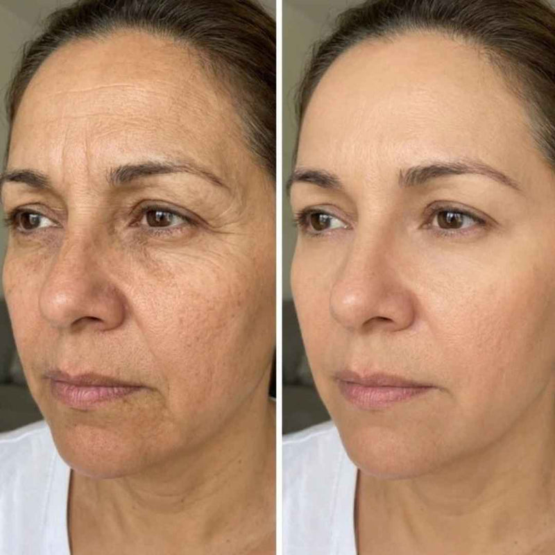 Antes y después