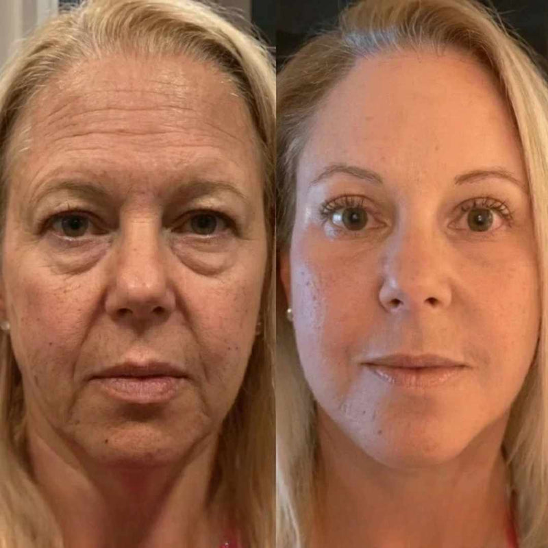 Antes y después