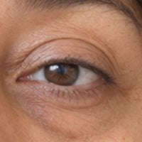 Ojeras/Mirada cansada