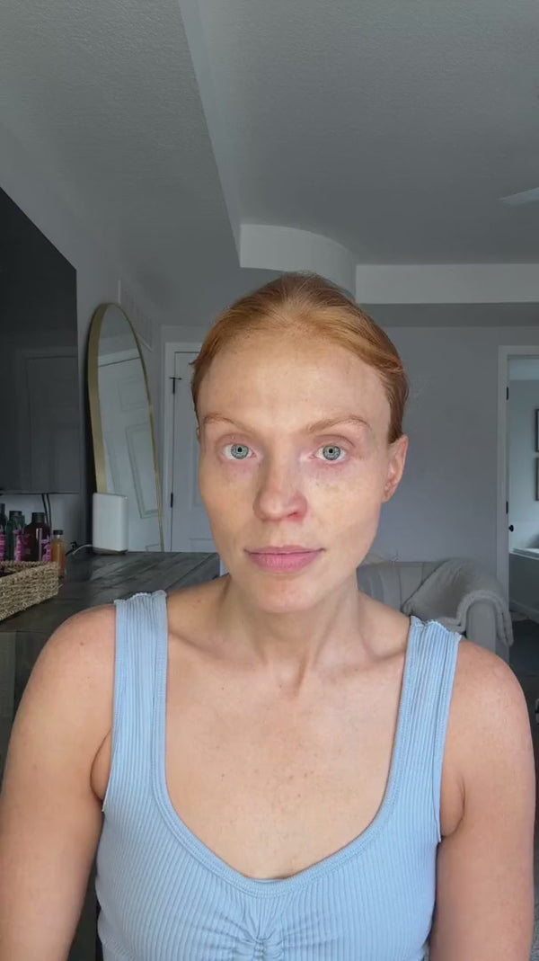 Testimonio en video de Koriderm